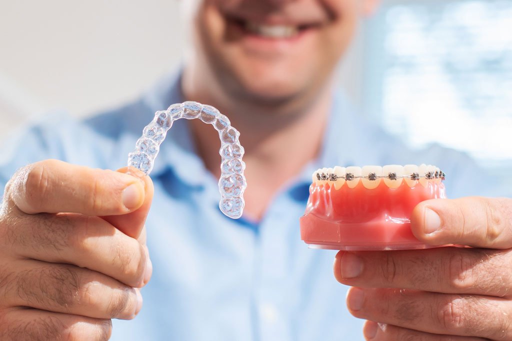 Clear Aligners vs. Braces: Which Option is Best for You?